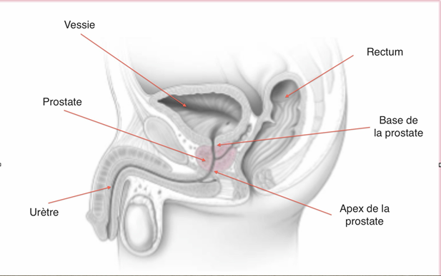 prostate schema