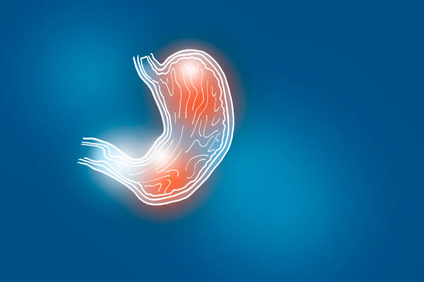 estomac avec zone enflammée