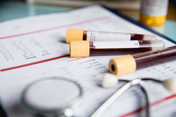 Tube de prélèvement sanguin utilisé pour les analyses médicales